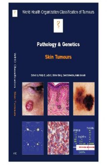 World Health Organization Classification of Tumours Pathology and Genetics of Tumours of the Skin