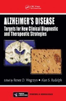 Alzheimer's: a caregiver's guide and sourcebook
