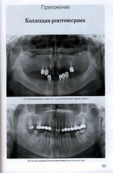Искусство рентгенографии зубов