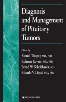 Diagnosis and Management of Pituitary Tumors