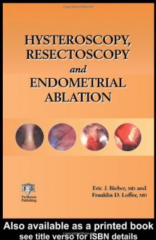 Hysteroscopy, Resectoscopy and Endometrial Ablation