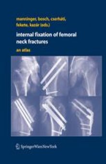 Internal fixation of femoral neck fractures: An atlas