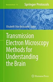 Transmission Electron Microscopy Methods for Understanding the Brain
