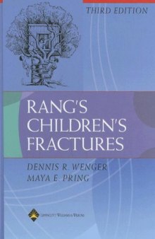 Rang's children's fractures