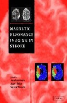 Magnetic resonance imaging in stroke
