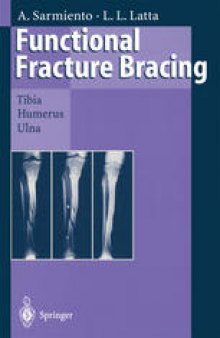 Functional Fracture Bracing: Tibia, Humerus, and Ulna