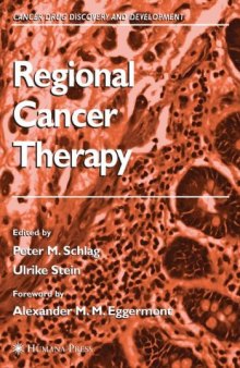 Regional Cancer Therapy. Cancer Drug Discovery and Development