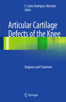 Articular Cartilage Defects of the Knee: Diagnosis and Treatment