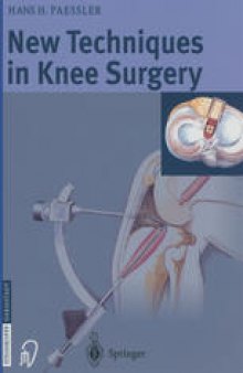 New Techniques in Knee Surgery