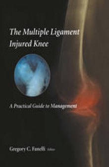 The Multiple Ligament Injured Knee: A Practical Guide to Management