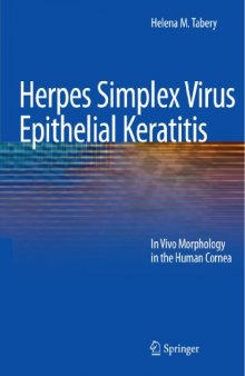 Herpes Simplex Virus Epithelial Keratitis: In Vivo Morphology in the Human Cornea