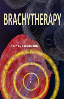 Brachytherapy