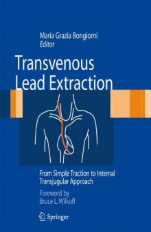 Transvenous Lead Extraction: From Simple Traction to Internal Transjugular Approach    