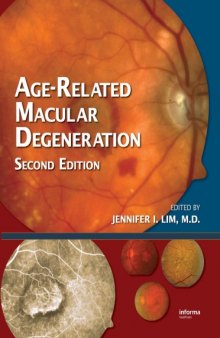 Age-Related Macular Degeneration, 2nd Edition