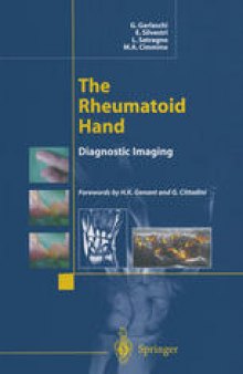 The Rheumatoid Hand: Diagnostic Imaging