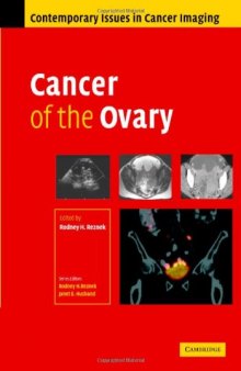 Cancer of the Ovary (Contemporary Issues in Cancer Imaging)