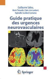 Guide pratique des urgences neurovasculaires  