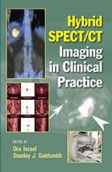 Hybrid SPECT/CT imaging in clinical practice