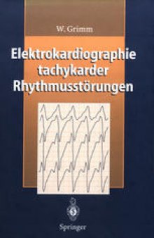 Elektrokardiographie tachykarder Rhythmusstärungen