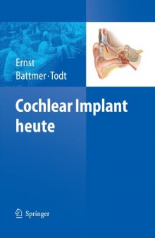 Cochlear Implant heute (German Edition)