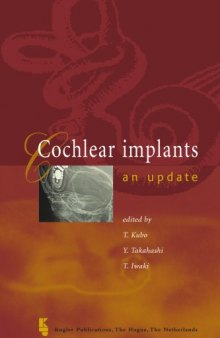 Cochlear Implants-An Update