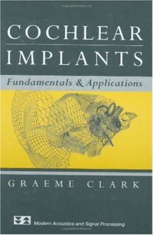 Cochlear implants: fundamentals and applications