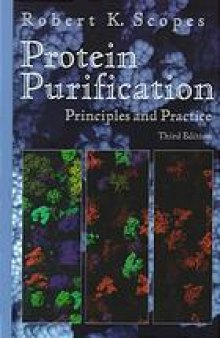 Protein purification : priciples and practice