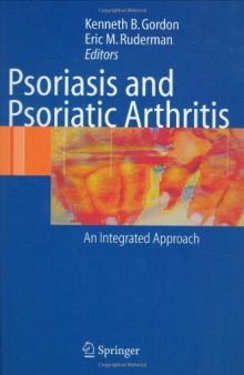 Psoriasis and Psoriatic Arthritis An Integrated Approach