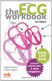 The Ecg Workbook
