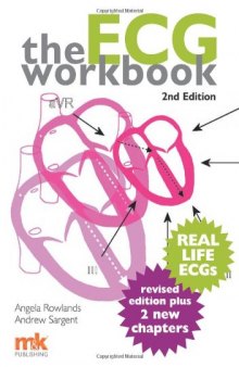 The ECG Workbook