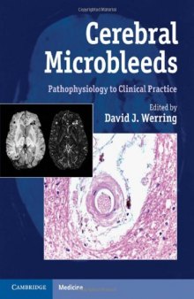 Cerebral Microbleeds: Pathophysiology to Clinical Practice