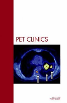 Lymphoma, An Issue of PET Clinics