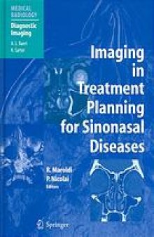 Imaging in treatment planning for sinonasal diseases