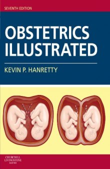 Obstetrics illustrated