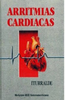 Arritmias Cardiacas