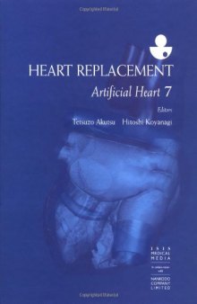 Heart Replacement: Artificial Heart 7