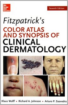 Fitzpatrick’s Color Atlas and Synopsis of Clinical Dermatology