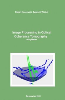Image Processing in Optical Coherence Tomography