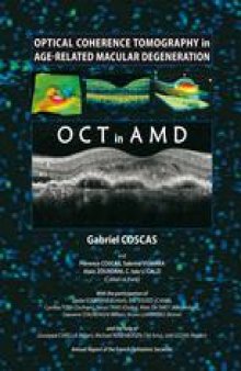 Optical Coherence Tomography in Age-Related Macular Degeneration: OCT in AMD