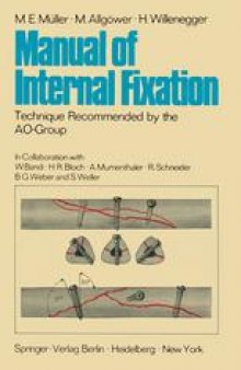 Manual of Internal Fixation: Technique Recommended by the AO-Group Swiss Association for the Study of Internal Fixation: ASIF