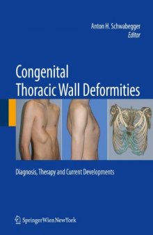 Congenital Thoracic Wall Deformities: Diagnosis, Therapy and Current Developments  