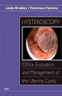 Hysteroscopy : office evaluation and management of the uterine cavity