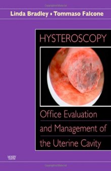 Hysteroscopy: Office Evaluation and Management of the Uterine Cavity