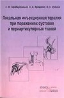 Локальная инъекционная терапия при поражениях суставов и периартикулярных тканей