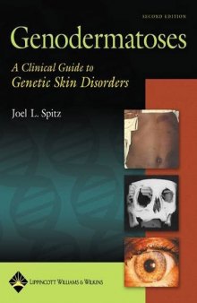 Genodermatoses : a clinical guide to genetic skin disorders