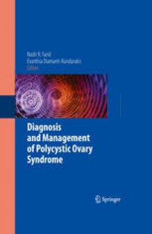 Diagnosis and Management of Polycystic Ovary Syndrome