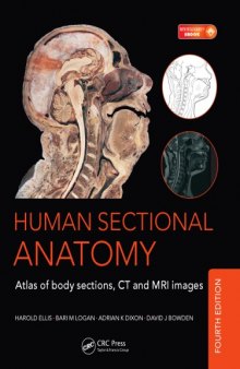 Human sectional anatomy : atlas of body sections, CT and MRI images