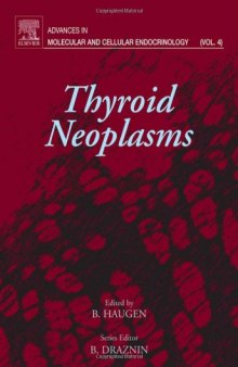 Thyroid Neoplasms