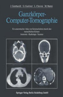 Ganzkörper-Computer-Tomographie: Ein anatomischer Atlas von Serienschnitten durch den menschlichen Körper Anatomie — Radiologie — Scanner