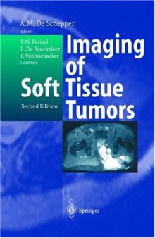 Imaging of Soft Tissue Tumors